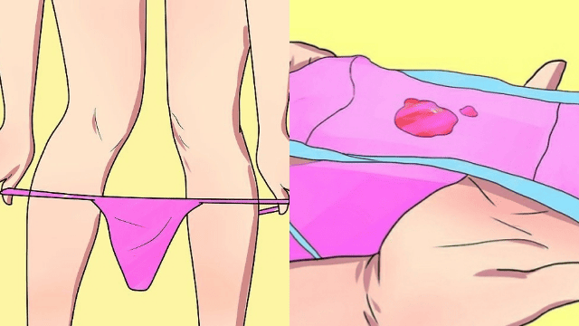 Dấu vết dịch nhầy trên đồ lót