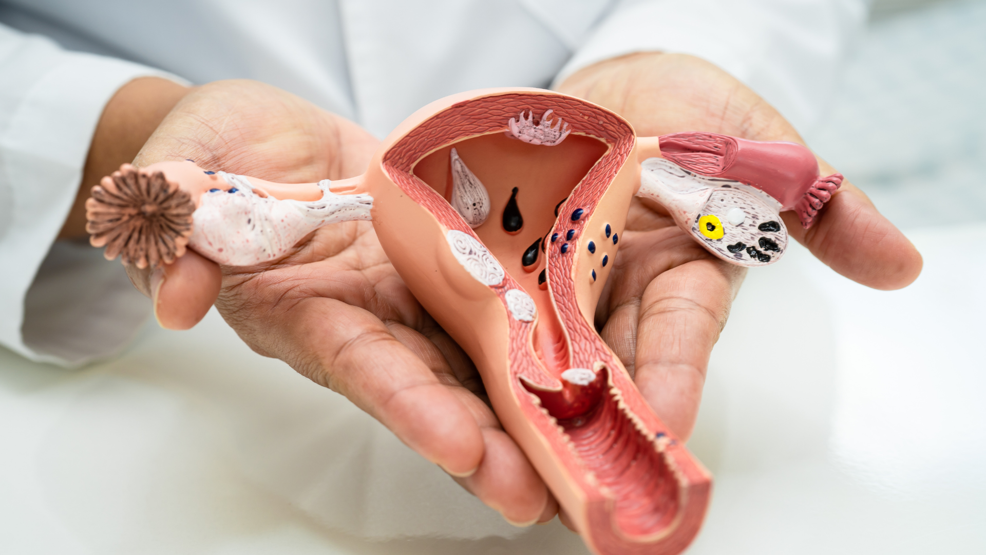 Khi nào cần gặp bác sĩ sau cắt buồng trứng