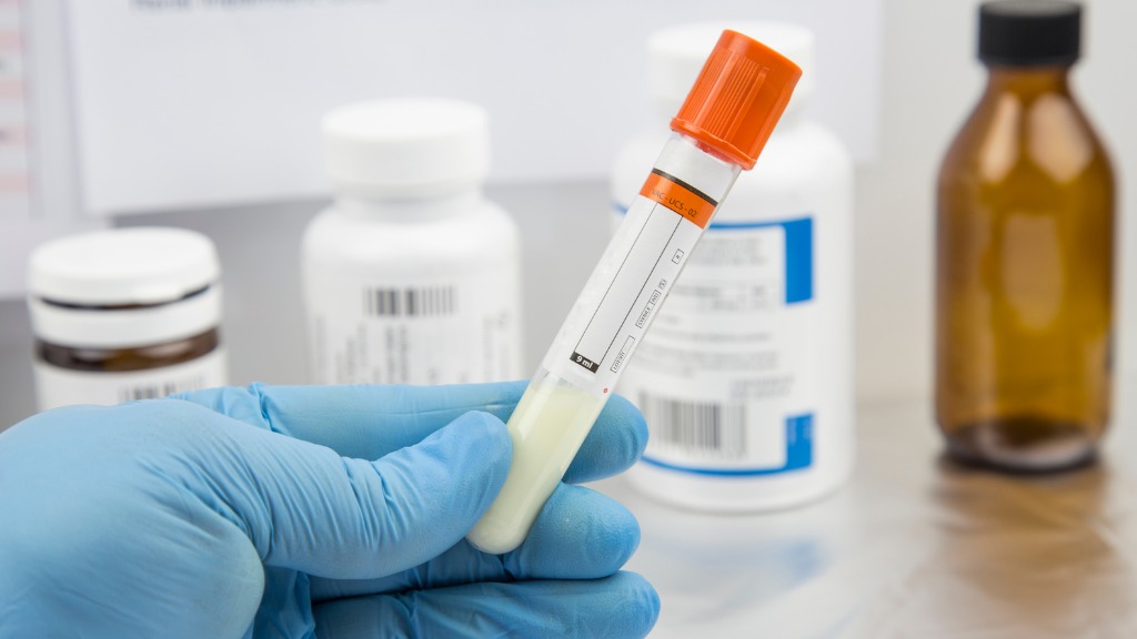 Xét nghiệm tinh dịch đồ