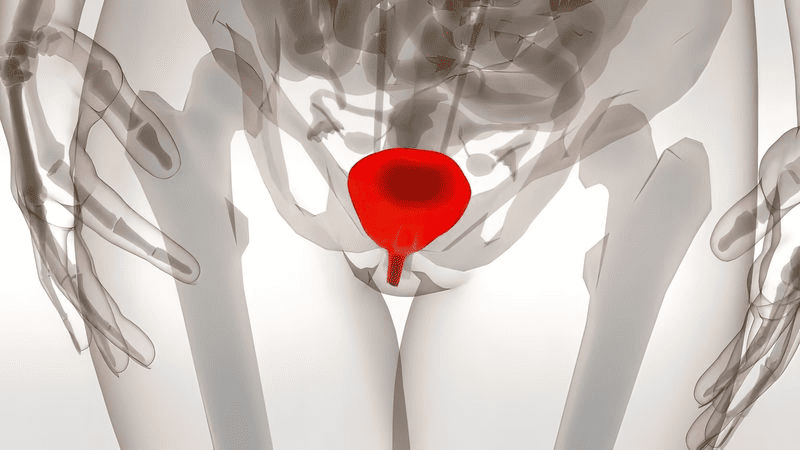 Nguyên nhân bệnh lý gây són tiểu khi quan hệ